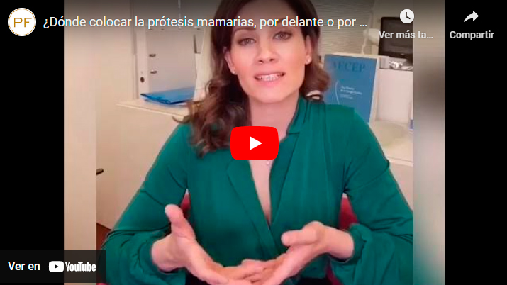 Protesis-mamarias-por-delante-o-detrás-del-músculo-pectoral